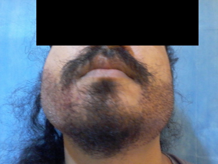 Imm Post Op (1)