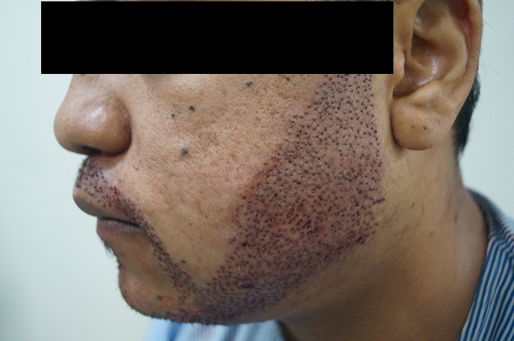 Imm Post Op 12