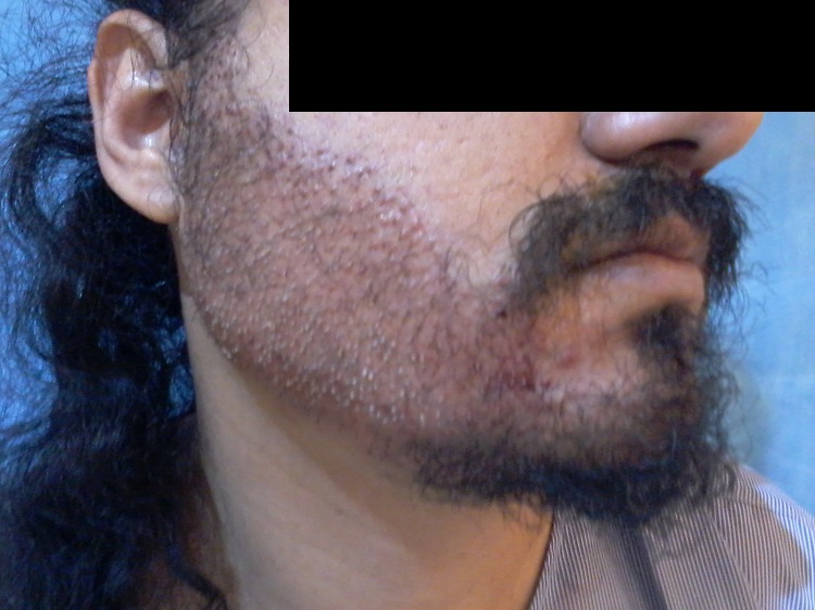 Imm Post Op (1)4