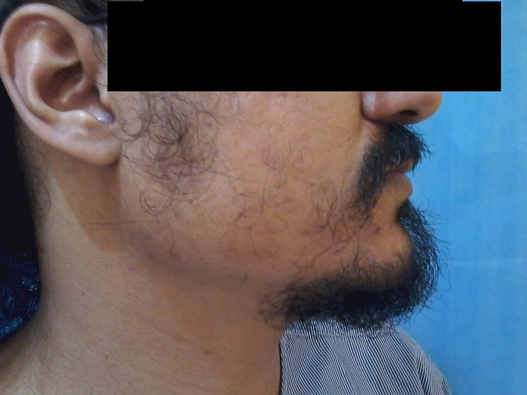 PreOp (1)4