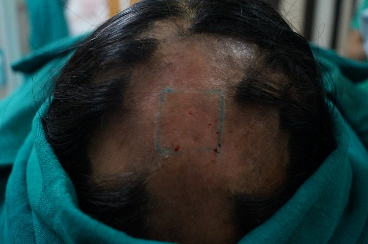 Pre Op (2)