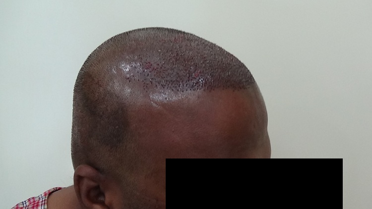 Imm Post Op (2)