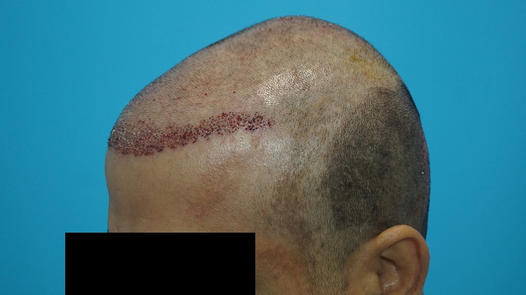 Imm Post Op (3)