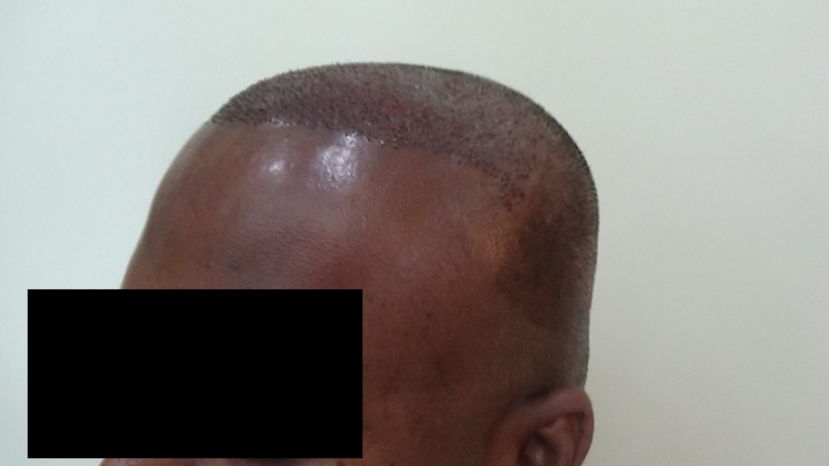 Imm Post Op (3)