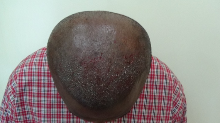 Imm Post Op (4)