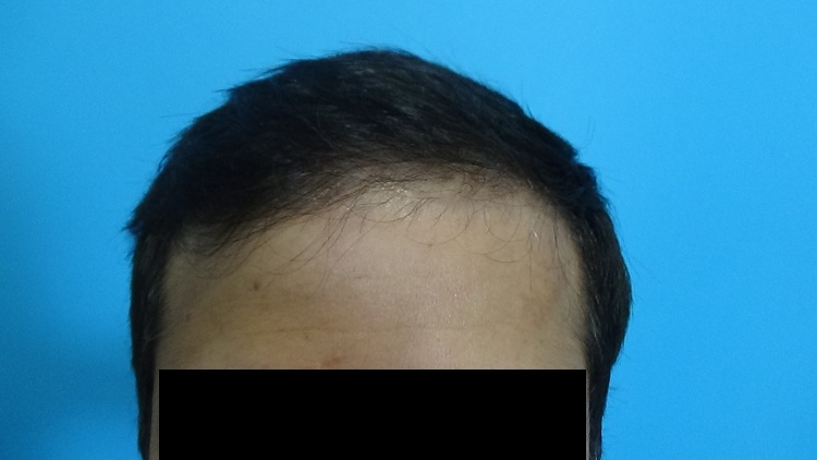 PreOp (2)