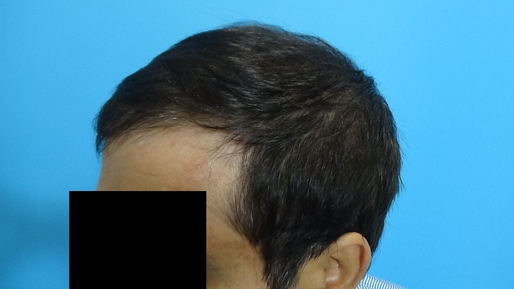 PreOp (3)