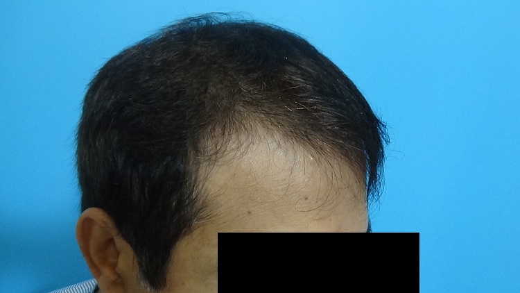 PreOp (4)