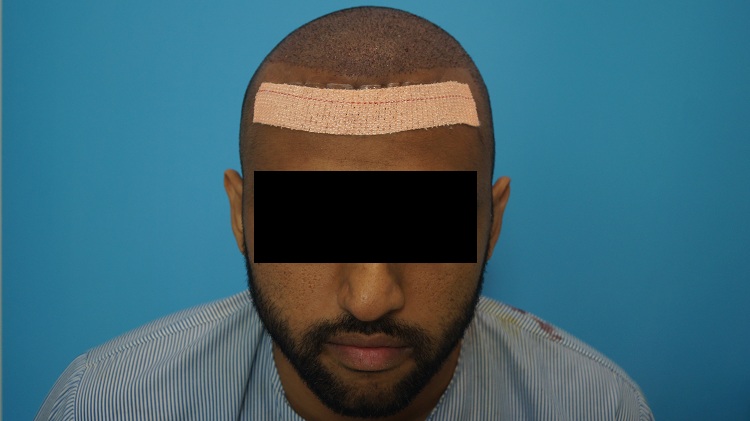 Imm Post Op (1)