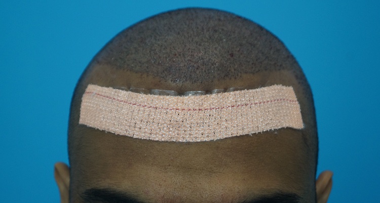 Imm Post Op (2)