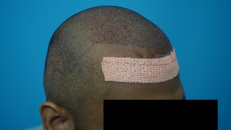 Imm Post Op (3)