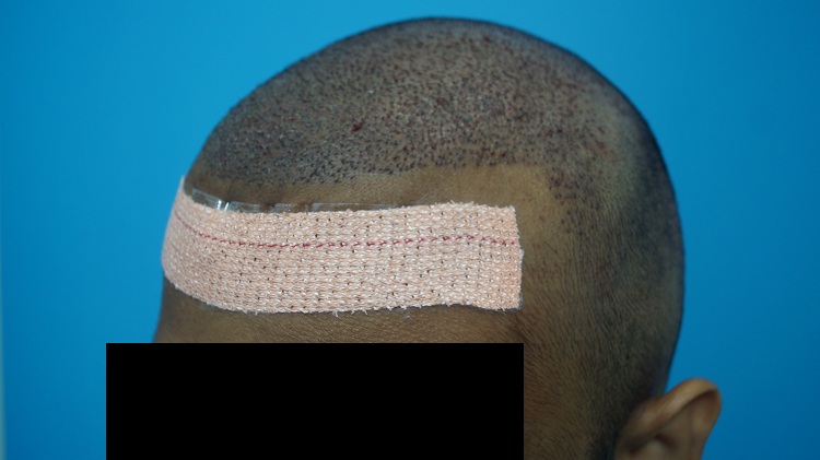 Imm Post Op (4)