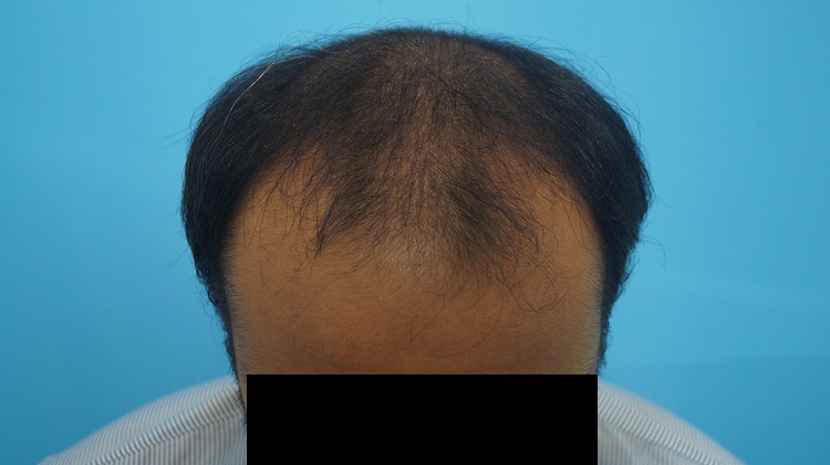 PreOp (2)