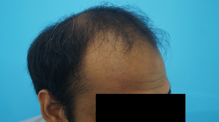 PreOp (3)