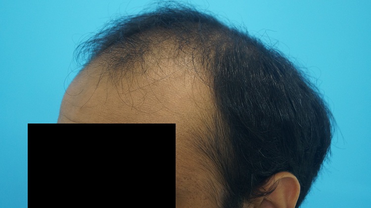 PreOp (4)
