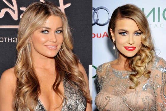 Carmen-Electra-Plastic-Surgery-Before-And-After