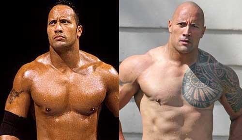Dwayne-Johnson cosmetic surgery pics