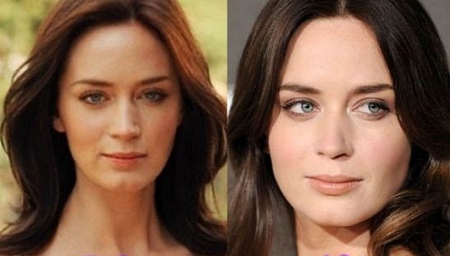 Emily Blunt plastic surgery
