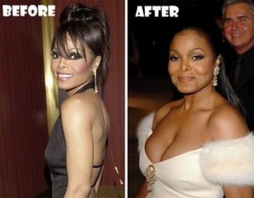 Janet-Jackson-plastic-surgery-before-and-after