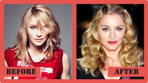 Madonna Plastic surgery