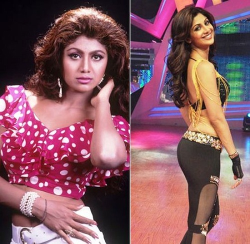 Shilpa-Shetty plastic surgery