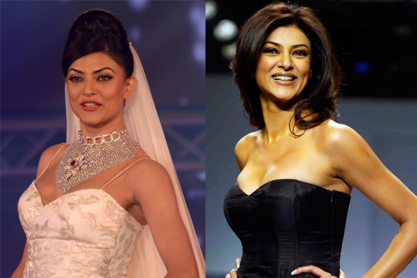Sushmita-Sen-Plastic-Surgery-Picture-Before-and-After