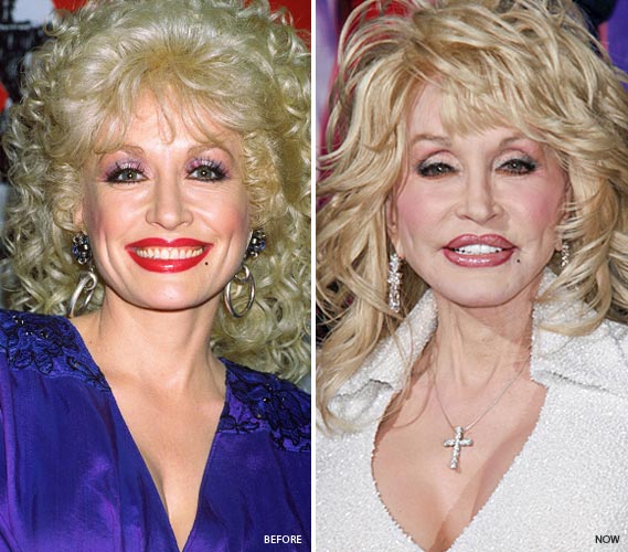 dolly-parton