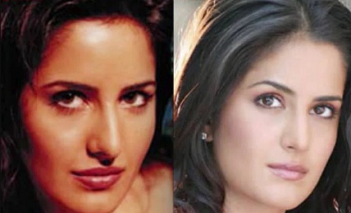 katrina kaif before and after surgery pics
