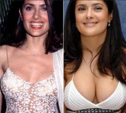 salma-hayek-breast-implants