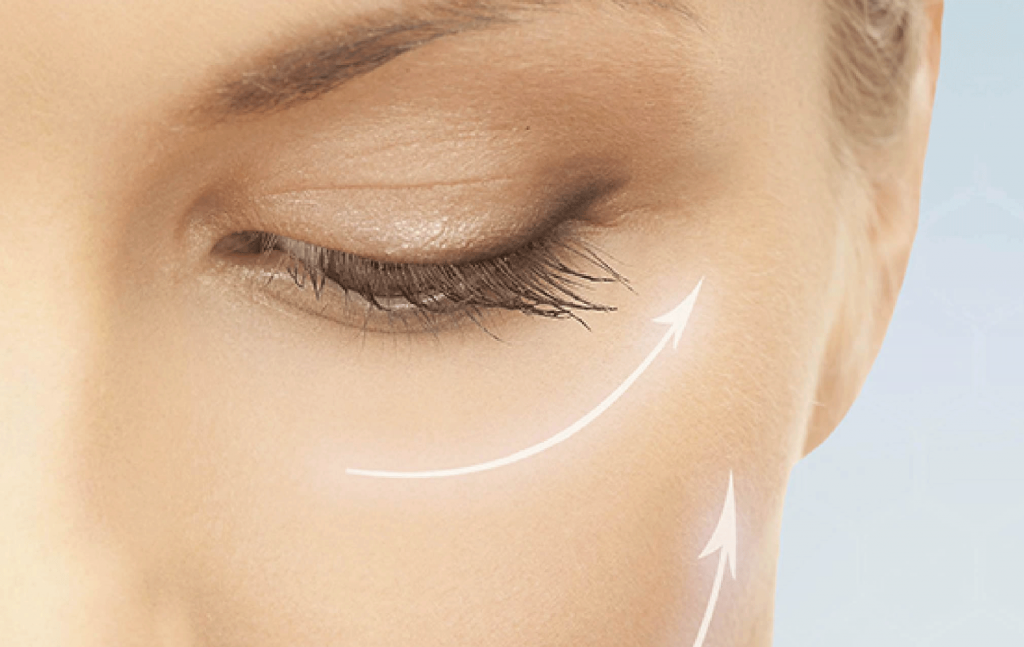 face lift radio frequency