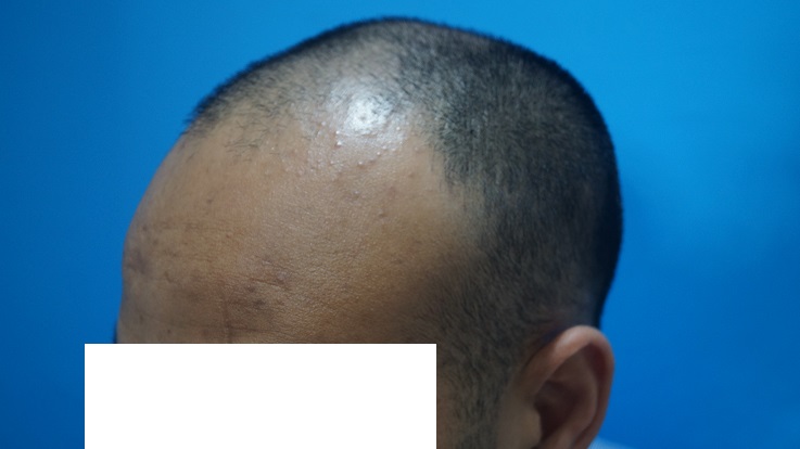 preop-6