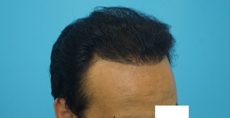 result-5