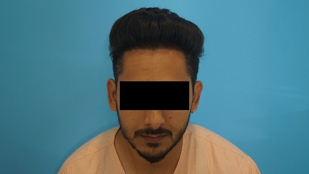after-1-yr-5