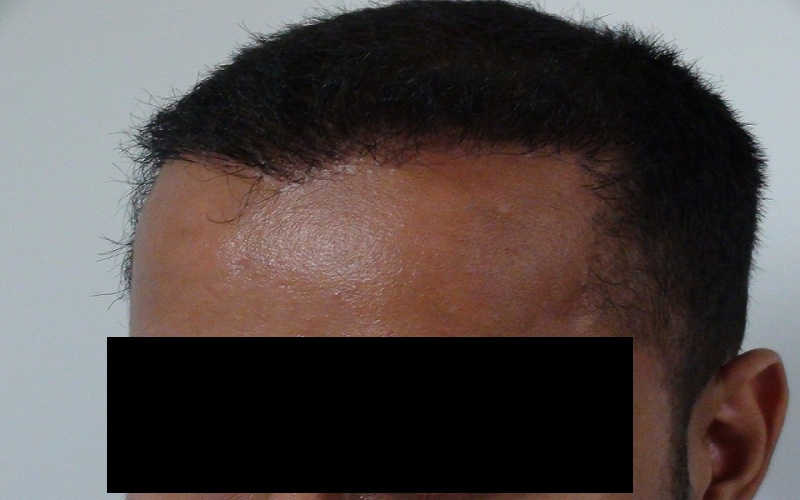 after-8-months-1