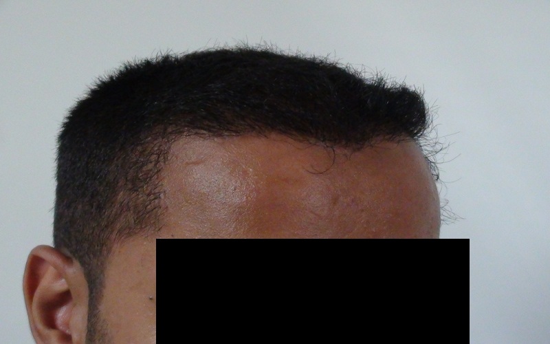 after-8-months-1