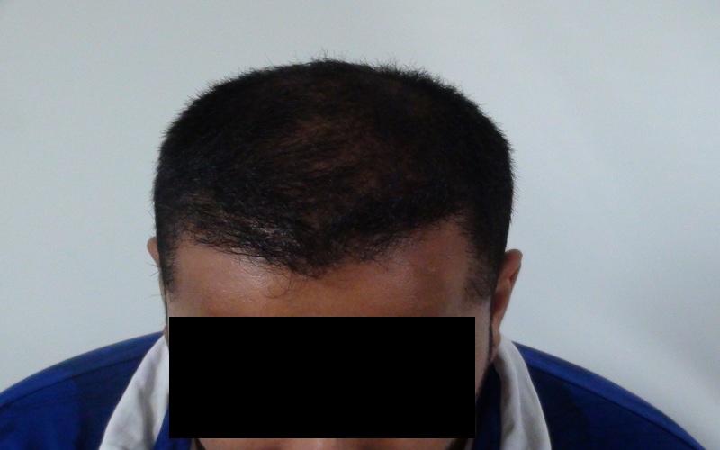 after-8-months-1