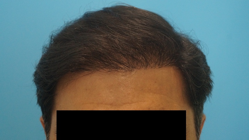 result patient 5