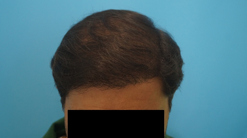 result patient 5