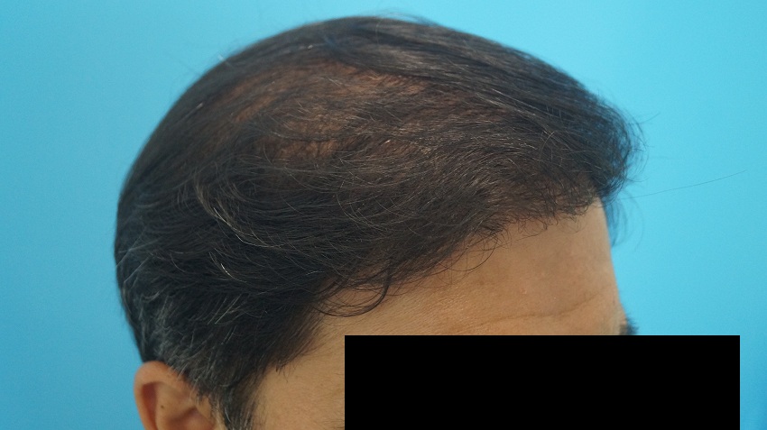 result patient 5