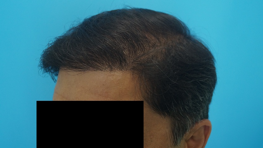 result patient 5
