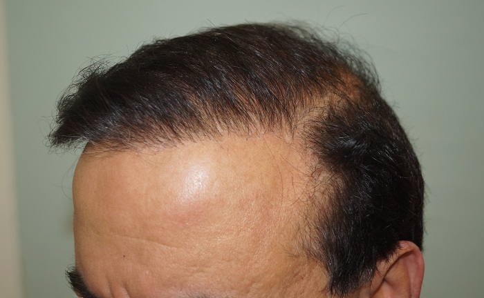 after-1-year-4