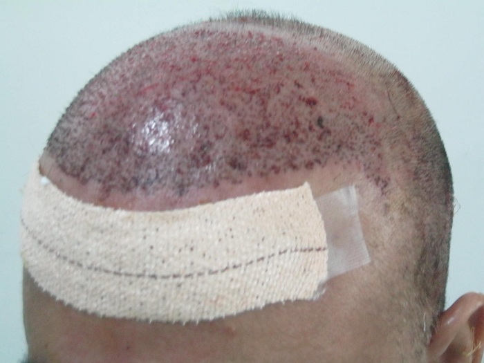 immidate-post-op-24