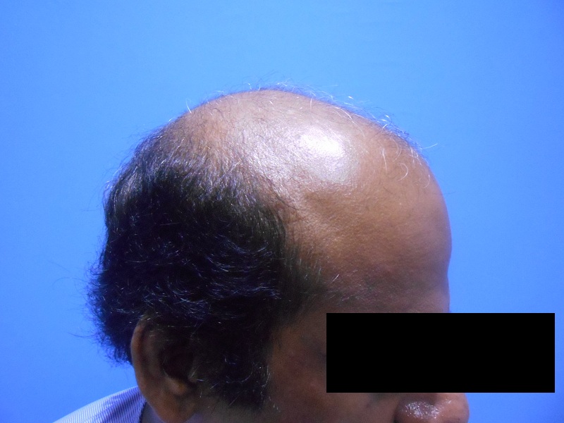 pre-op-3