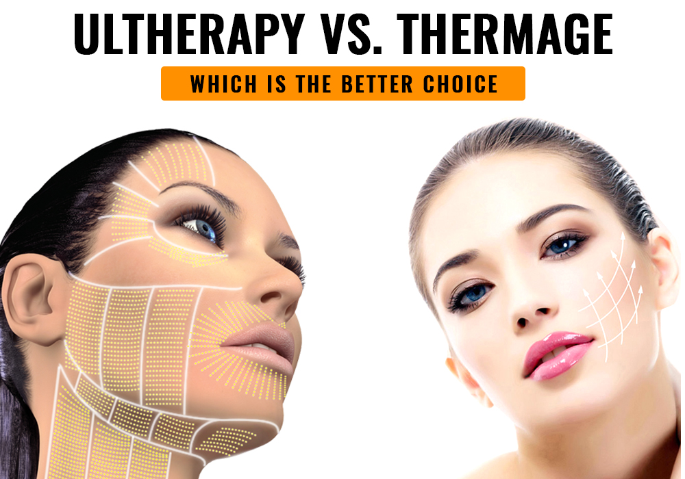 UltherapyVsThermage