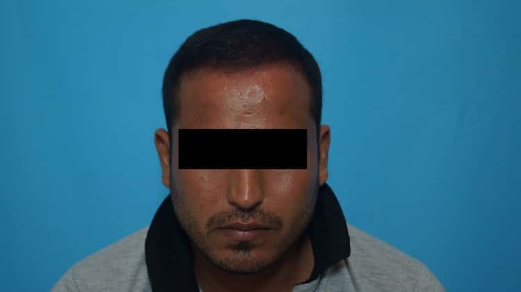 Result after 8 months (1)-min