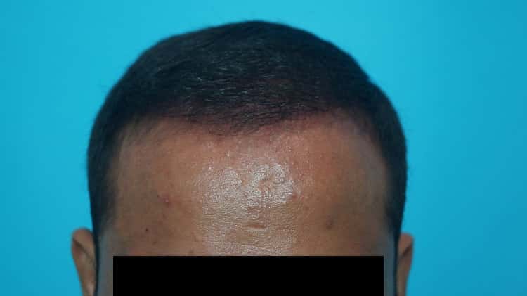 Result after 8 months (2)-min