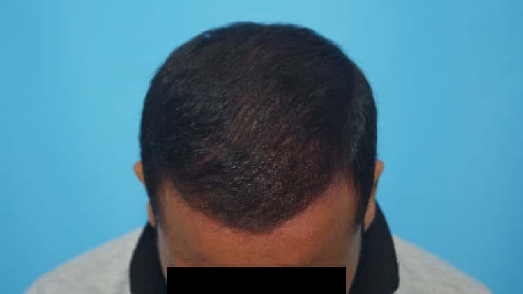 Result after 8 months (3)-min