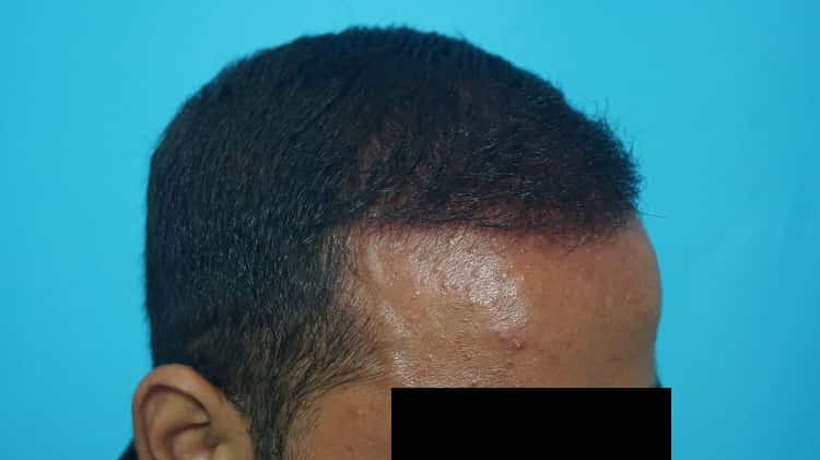 Result after 8 months (4)-min