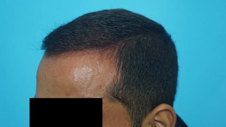 Result after 8 months (5)-min