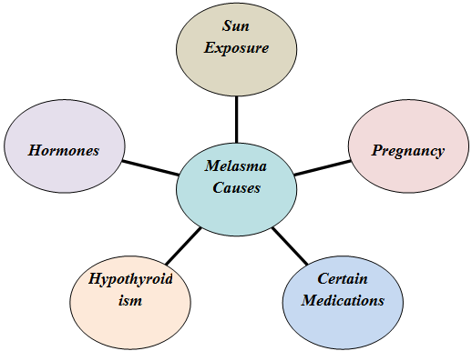 Causes of Melasma